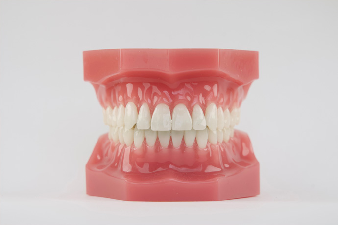 Lingual Orthodontics